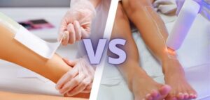 Waxing vs Laser Hair Removal: Which Works Best?