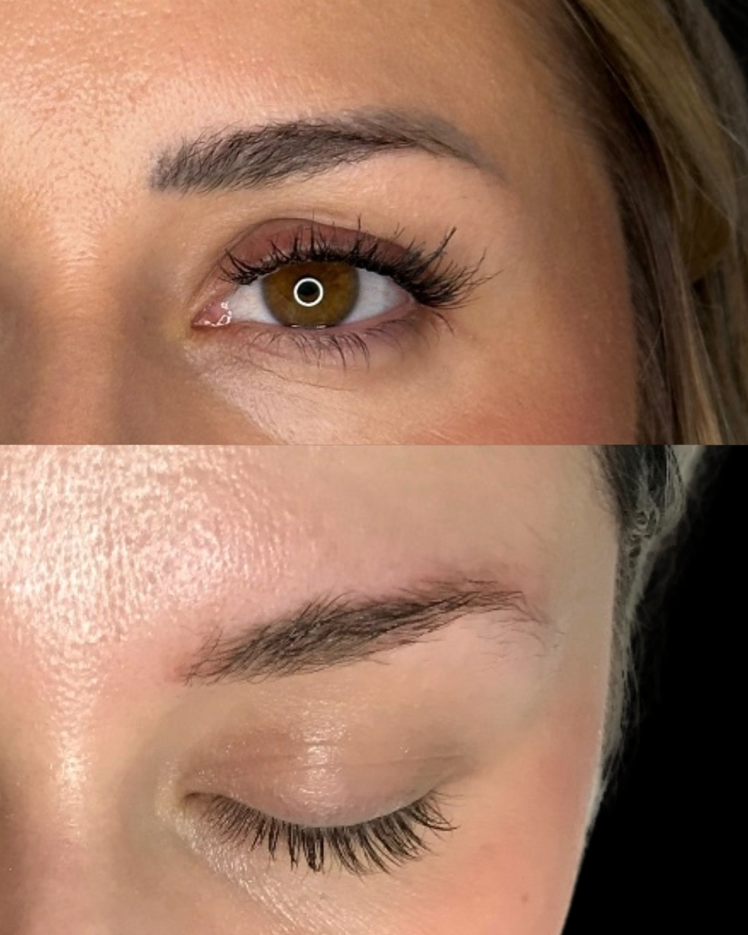 Jessica C- Microblading Removal- 2 sessions (2)