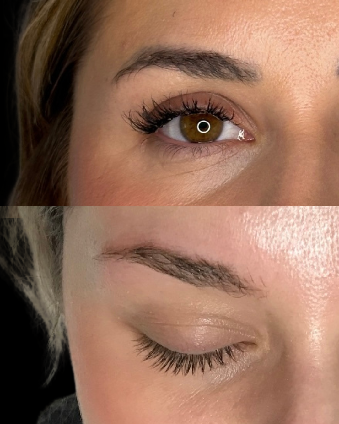 Jessica C- Microblading Removal- 2 sessions (3)