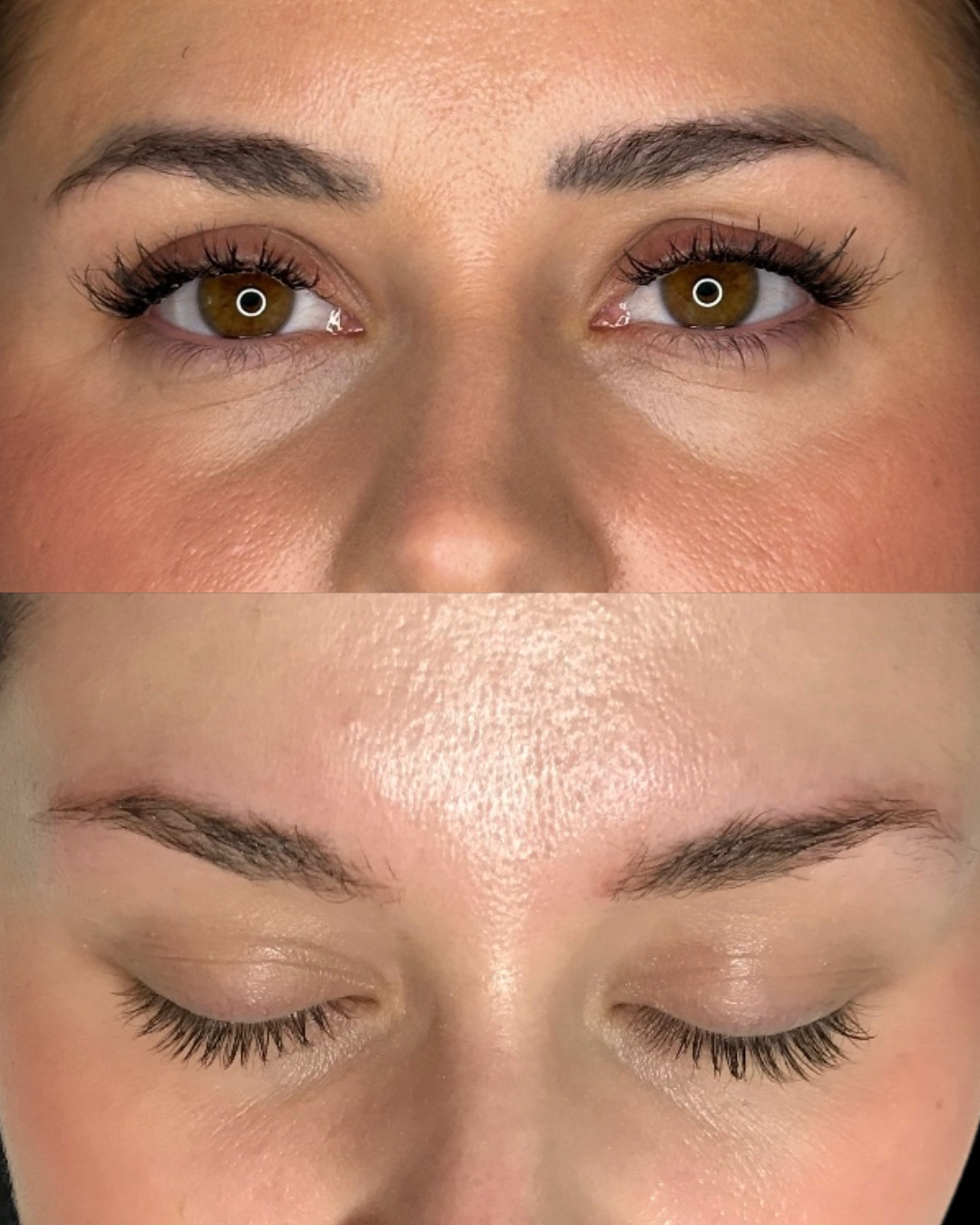 Jessica C- Microblading Removal- 2 sessions