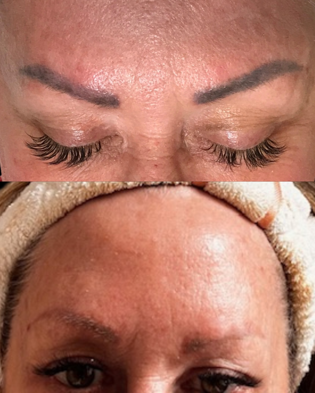 Leslie M - Microblading Removal 2 Session